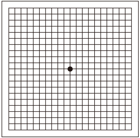 加齢黄斑変性症